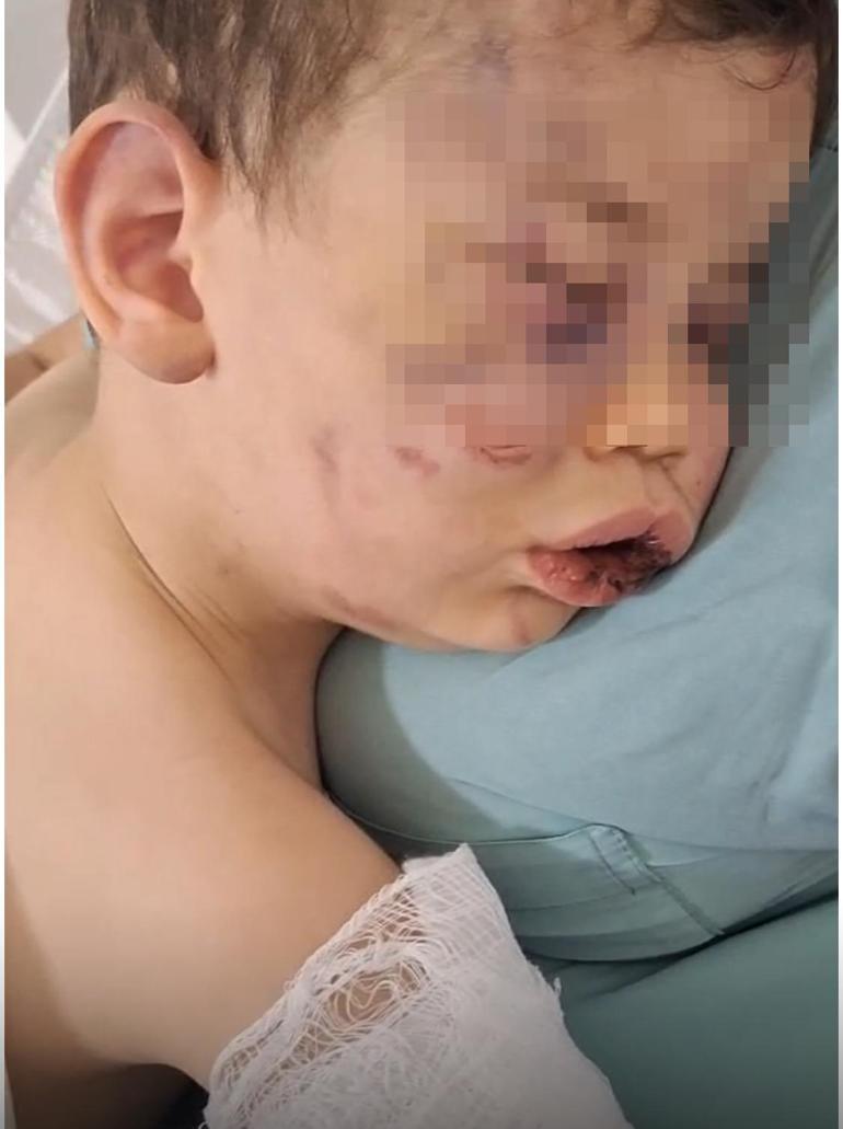 Denizli’de 2 yaşındaki bebek darp edildi Hayati tehlikesi devam ediyor...
