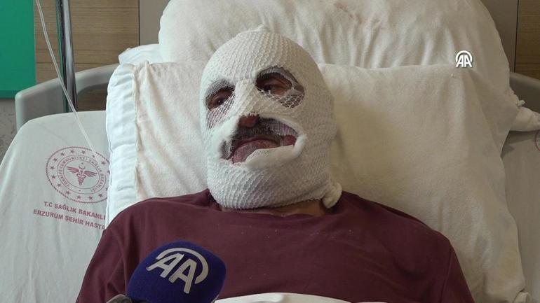 Gaz kaçağını çakmakla kontrol etti, ölümden döndü
