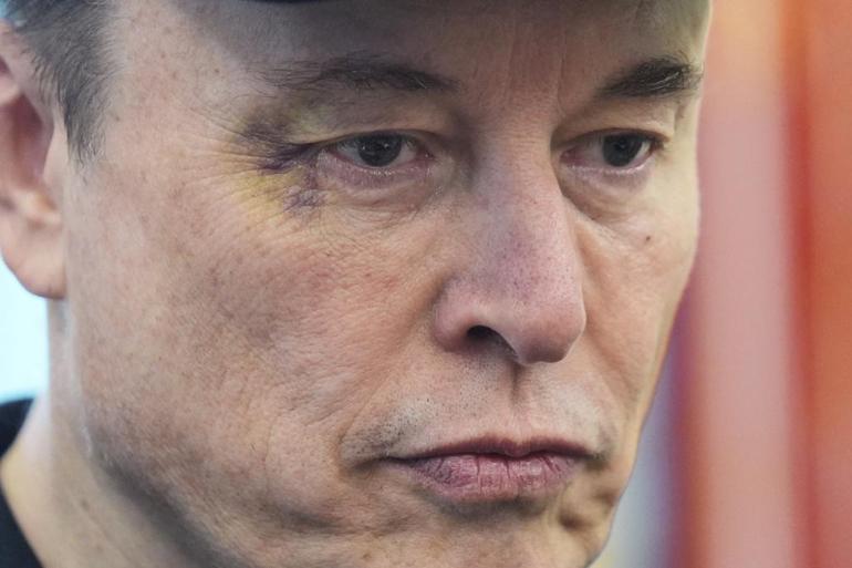 Elon Musk gözünü kimin morarttığını açıkladı