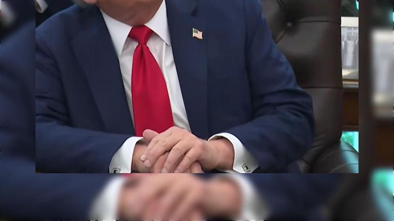 Trump’ın elindeki morluk yine olay oldu