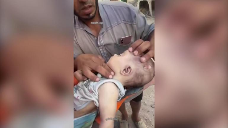 Gazzede minik canı kurtarmak için zamanla yarıştı