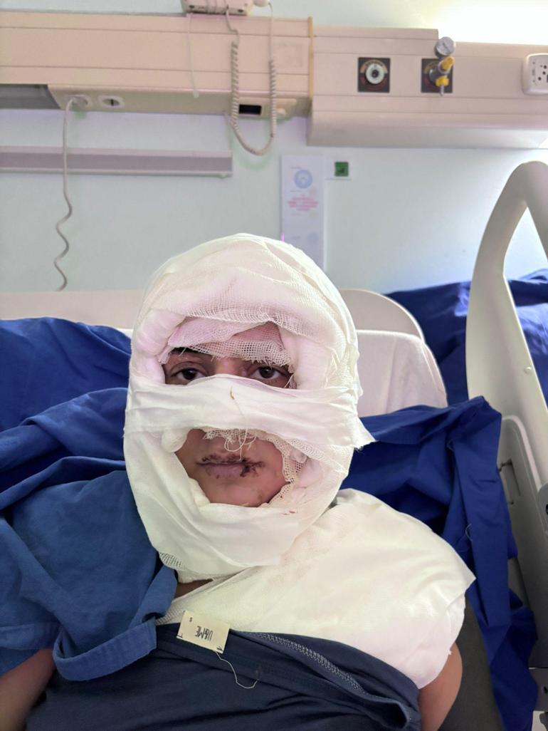 Kadıköyde korkunç anlar Kadının üzerine yanıcı madde atıp kaçtı