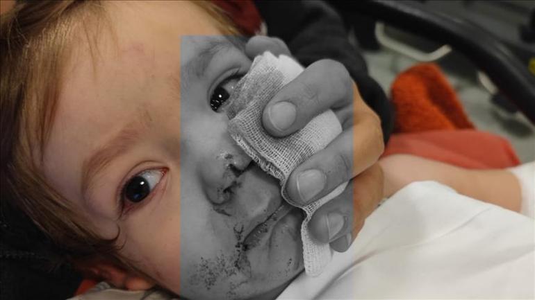 Ankarada 2 çocuğu yaralayan pitbull cinsi köpeğin sahibi tutuklandı