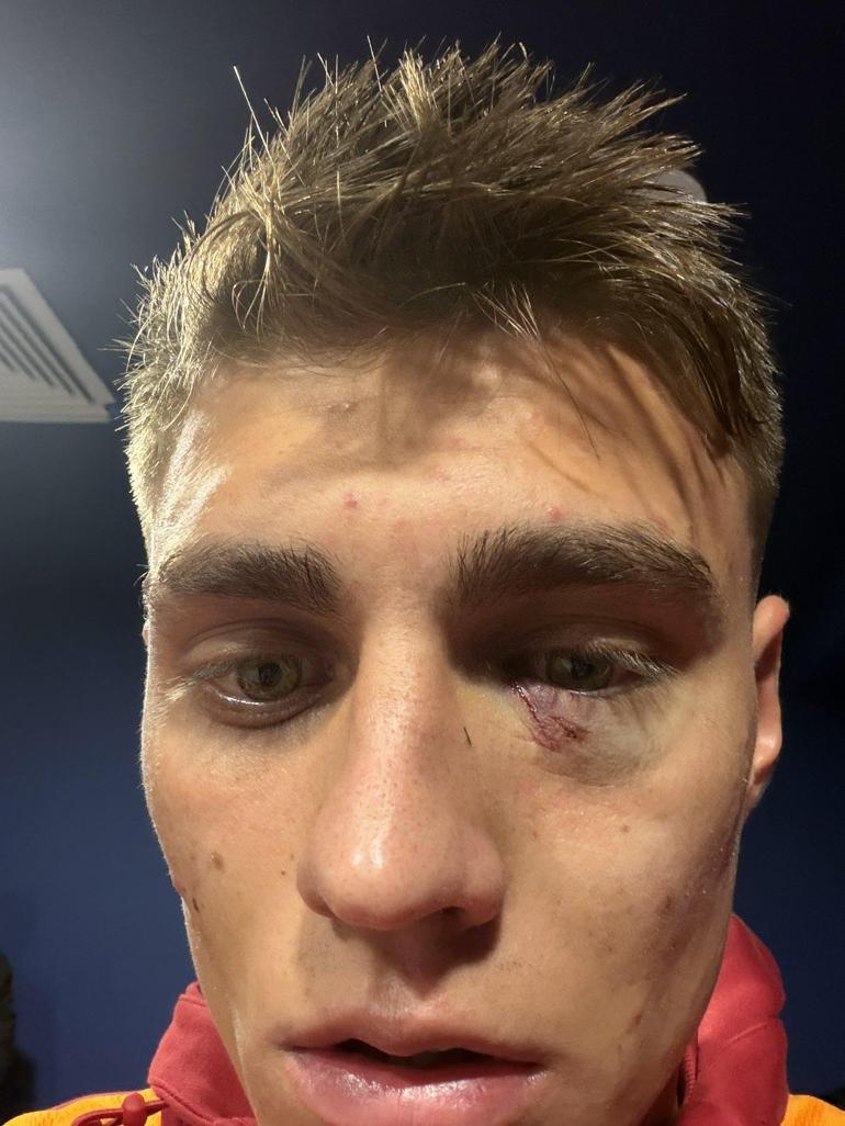 Kazımcan Karataşa çakmak atan taraftarın cezası belli oldu