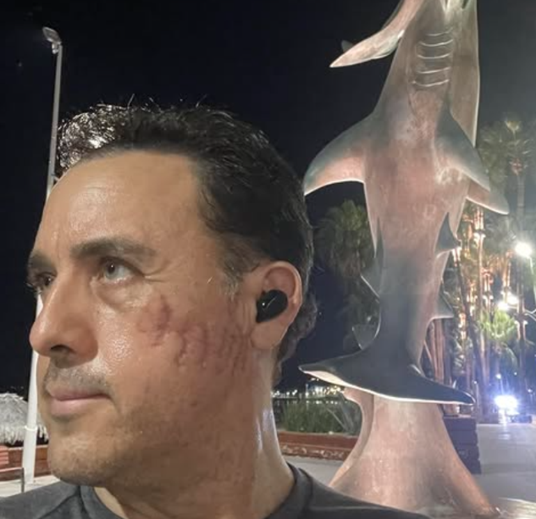 40 metre derinlikte dehşet Köpek balığı saldırısından sağ kurtuldu: Birden çenesini tekrar açtı, isteseydi öldürebilirdi