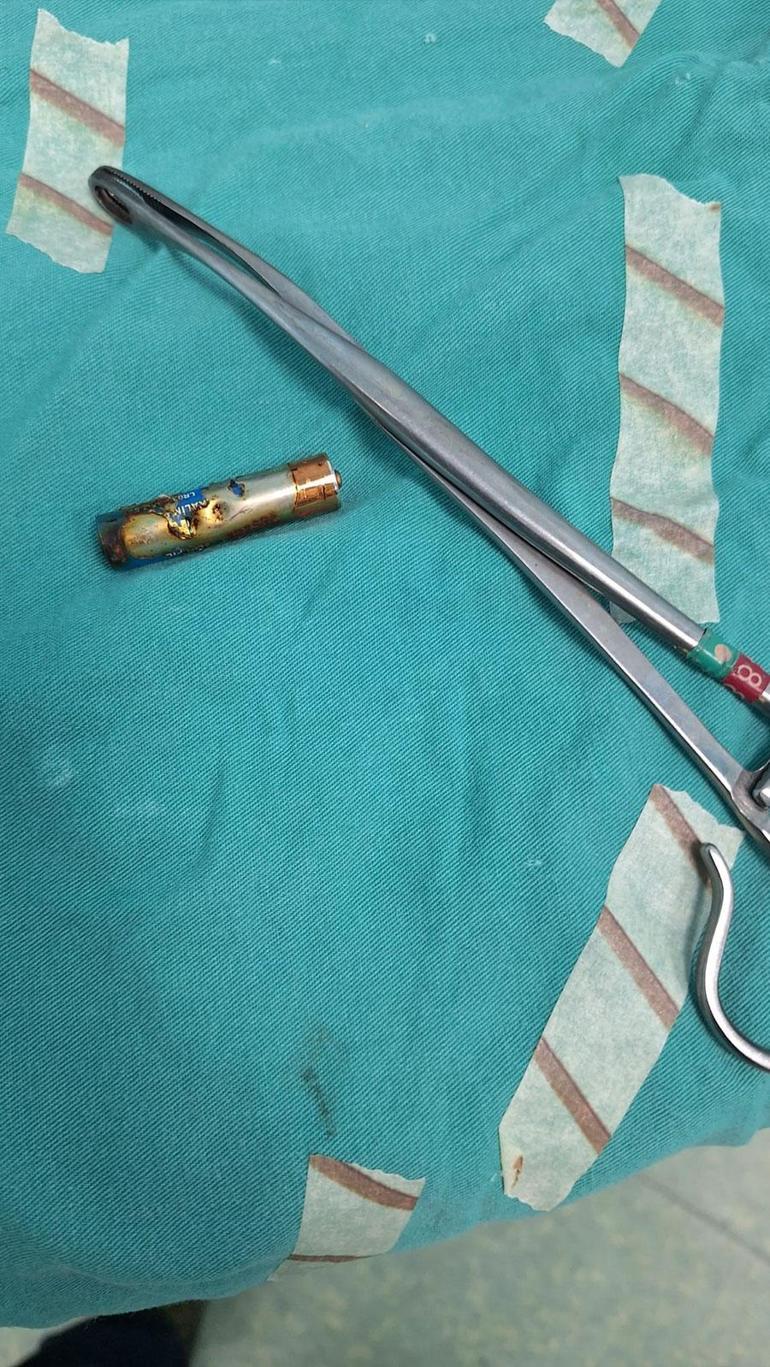 6 aylık bebeğin boğazına kumanda pili kaçtı