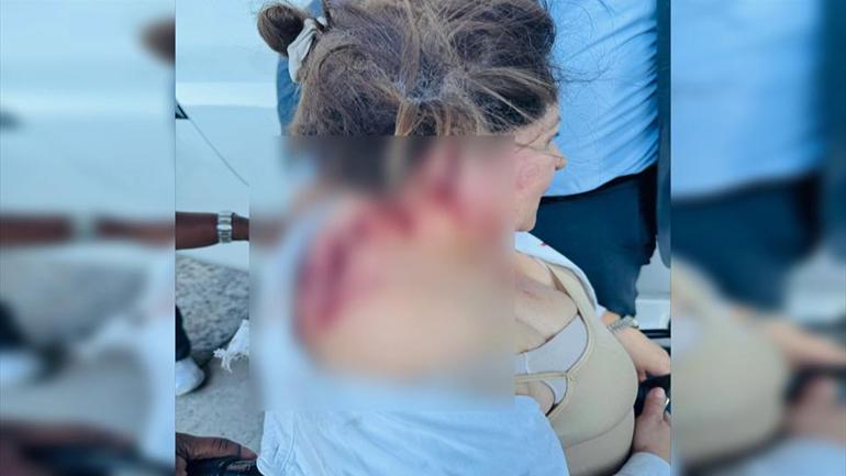 Hondurasta vekilin sırtında bomba patladı