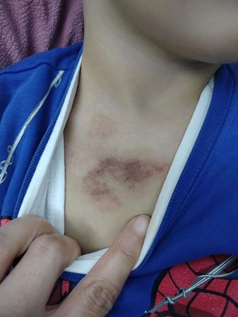  Çocukları tacize uğrayan aile şikayetçi oldu