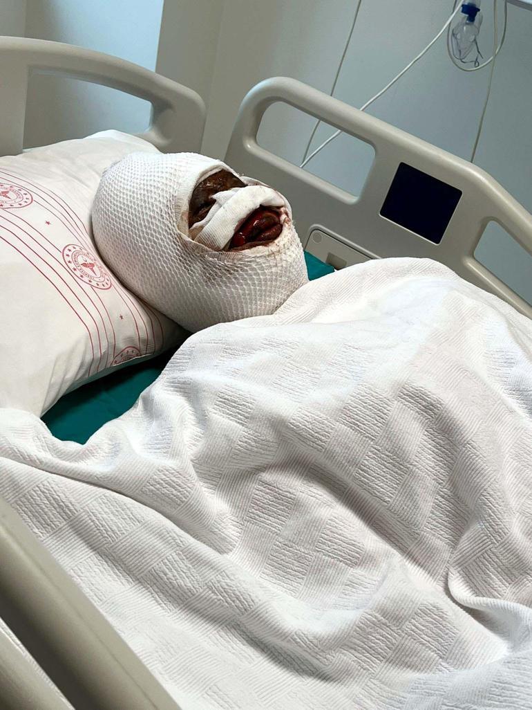 Eski eşine kimyasal maddeyle saldıran kişi tutuklandı