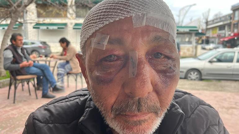 Kocaelide akılalmaz olay Önce çakmak istediler, sonra hastanelik ettiler