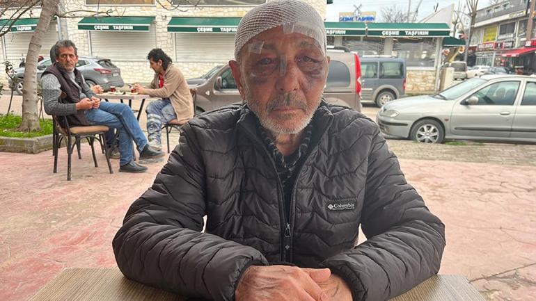 Kocaelide akılalmaz olay Önce çakmak istediler, sonra hastanelik ettiler