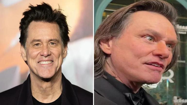 Jim Carreynin son hali şoke etti Maalesef botoks kurbanı