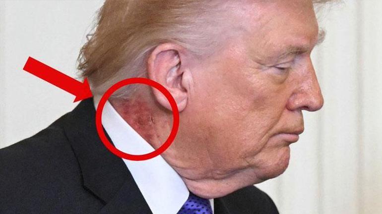 Önce eli şimdi de boynu: Trumpın doktorundan açıklama