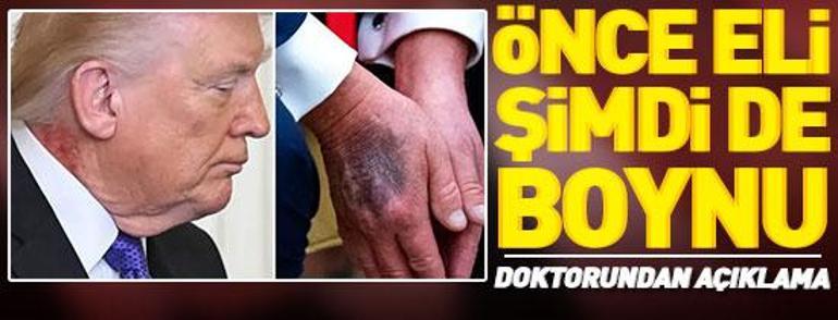 SON DAKİKA... ABD, İsrail - İran savaşı kızışıyor: İranın yeni dini lideri belli oldu mu Bölgeden son gelişmeler CNN TÜRK canlı yayınında