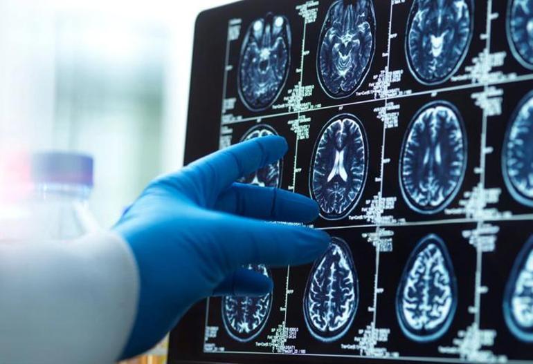 Konuşma temponuz beyin yaşınızı ele veriyor Bunları yapıyorsanız dikkat Nedeni düşündüğünüzden ciddi olabilir