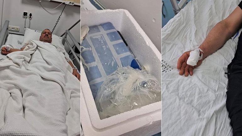  Manisa... Köpek saldırısına parmağı koptu