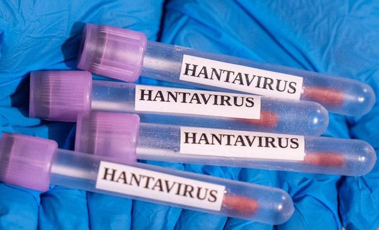 Kabus başlamadan sona mı erdi Hantavirüste güncel tablo açıklandı