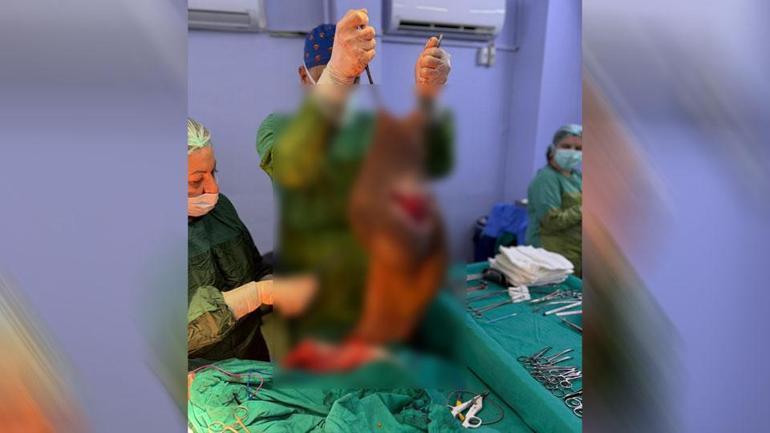 Hastanın karnından çıkarıldı: Tam 40 kilogram