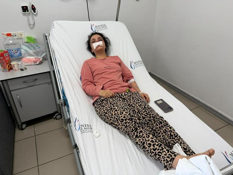 Eşi tarafından burnu ısırılıp koparılan kadın konuştu: Acıyla balkondan atlamayı bile düşündüm