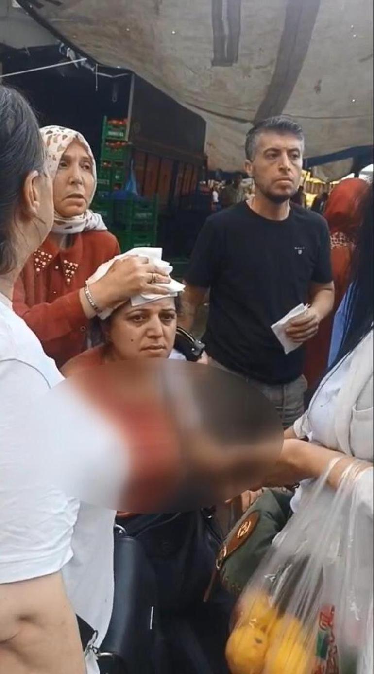  Pazarcının kalasla yaraladığı kadının kafasına 10 dikiş atıldı