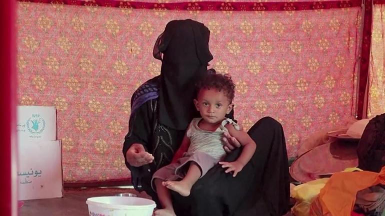 UNICEFten yemen için kritik uyarı